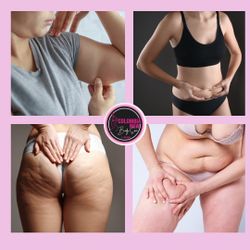 Hair Removal  Depilación Láser Permanente 