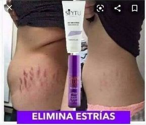 🔴Elimina la estrías con la crema Seytu