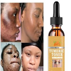 50ML/Turmeric Lemon Skin Glow Face Serum Acne Dark Spot Whitening Black Patches Melasma Corrector Brightening Essential Oil Skin Care