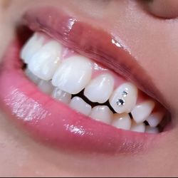 Tooth Jams