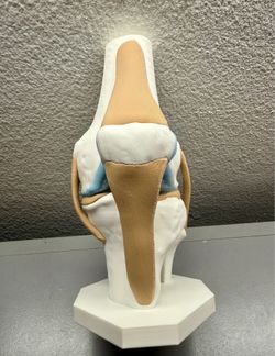 STRATA 3D Prints - Knee Anatomy Model