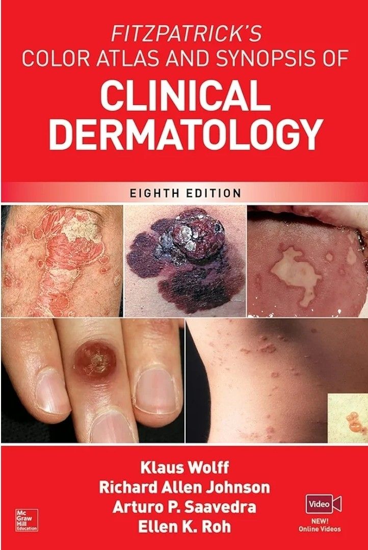 Clinical Dermatology, Fitzpatrick's Color Atlas And Synopsis