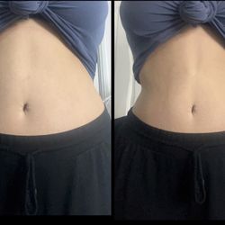 Lipo