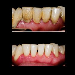 Dental