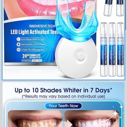 Teeth Whitening Kit – 3 Teeth Whitening Pens + 2 Desensitizing Pens – LED Light – 35% Carbamide Peroxide – Safe & Dentist-Recommended – Fast 7-Day Vis