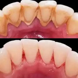 DENTAL CLEANING! 🦷✨ Tuesday & Thursdays