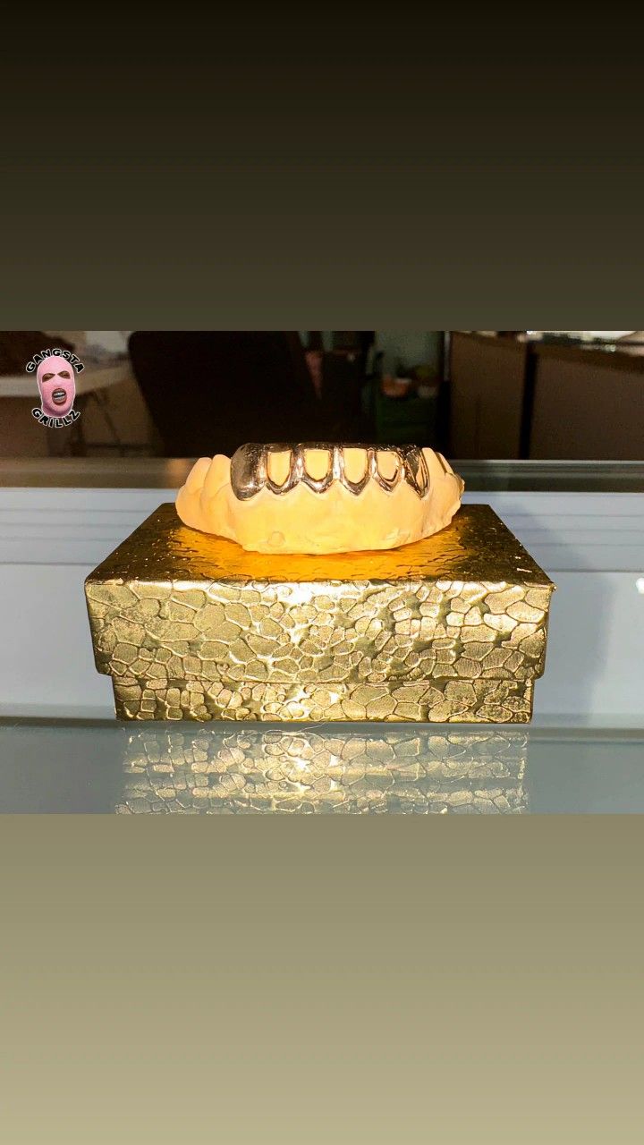 4 Open Face, 2 Solid Gold