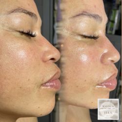 Skin Care products