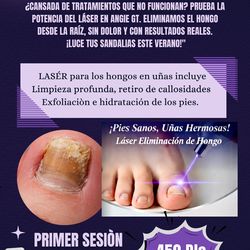 Hongos en tus uñas?