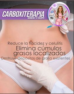 Carboxiterapia