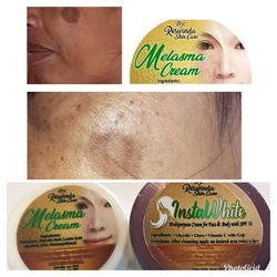 Melasma Cream Instawhite Multipurpose Cream For Face Body SPF 50