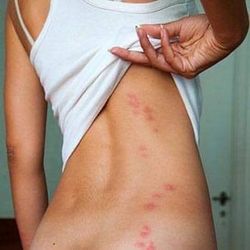 Te Gustaria Acabar Con Las Plagas?