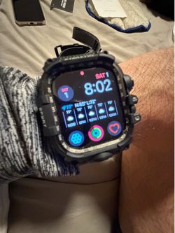 Apple Watch Series 11