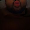bulkie_dimples
