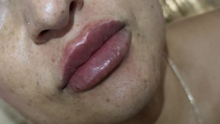 Lip 👄 Filler and More