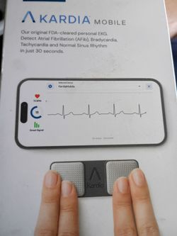 Kardia mobile EKG