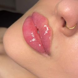 Lip Enhancer