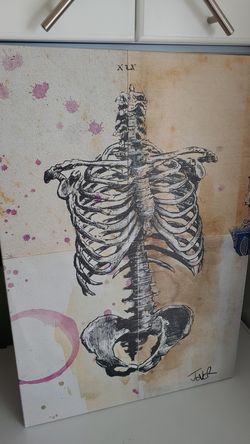 Canvas art