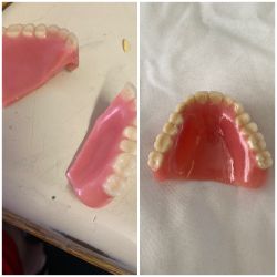 Dentures / partials 