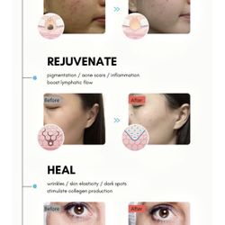 New Tech LED Face Mask