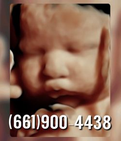 BABY ULTRASOUND!