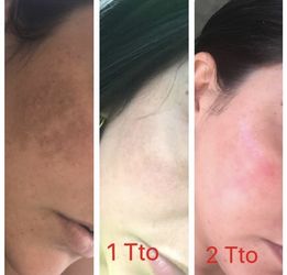 Skin Care