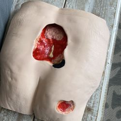 Stan Stage IV Pressure Ulcer Model - Wound Care Training Model 