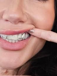 Gold grill