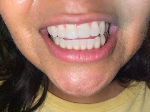 Blancamientos Y Mas Dentales