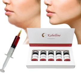 Fat Solution Body Contouring Kabellines Kybella
