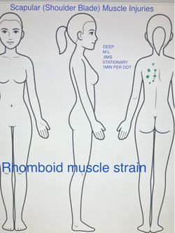 Back Pain
