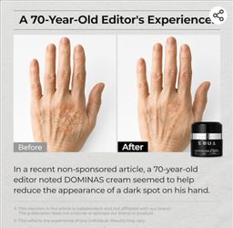 DOMINAS TXA Spot Corrector Cream 1.76 oz