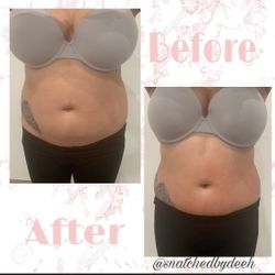BodySculpting Machine