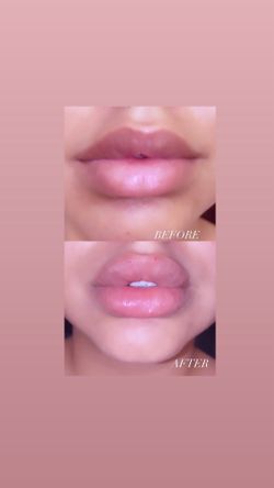 lips