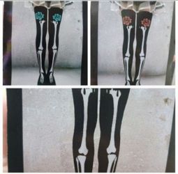 Black Skeleton Print Thigh High Stockings