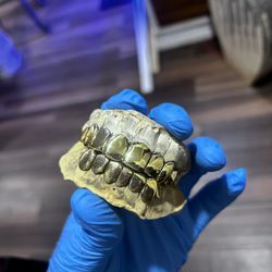 8 On 8 Gold Grillz - Mobile Jeweler Orlando 