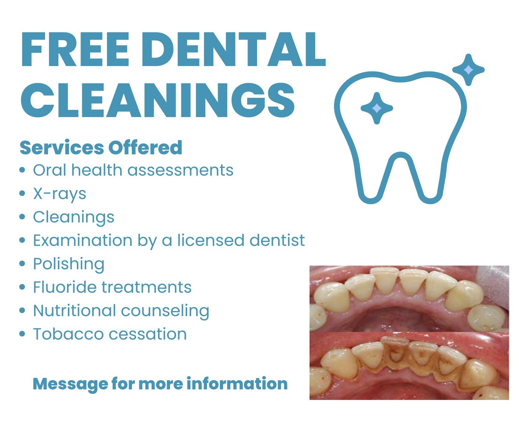 Free Dental Cleanings