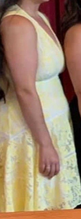 Yellow And White Lace Dress