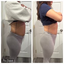 Body Sculpting