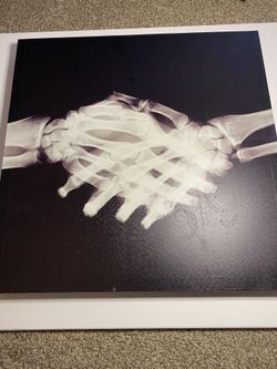 X Ray canvas Art 