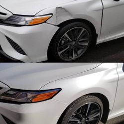Auto body