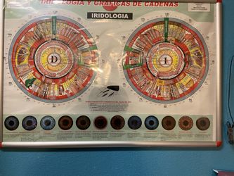 EXAMEN DE IRIDOLOGIA