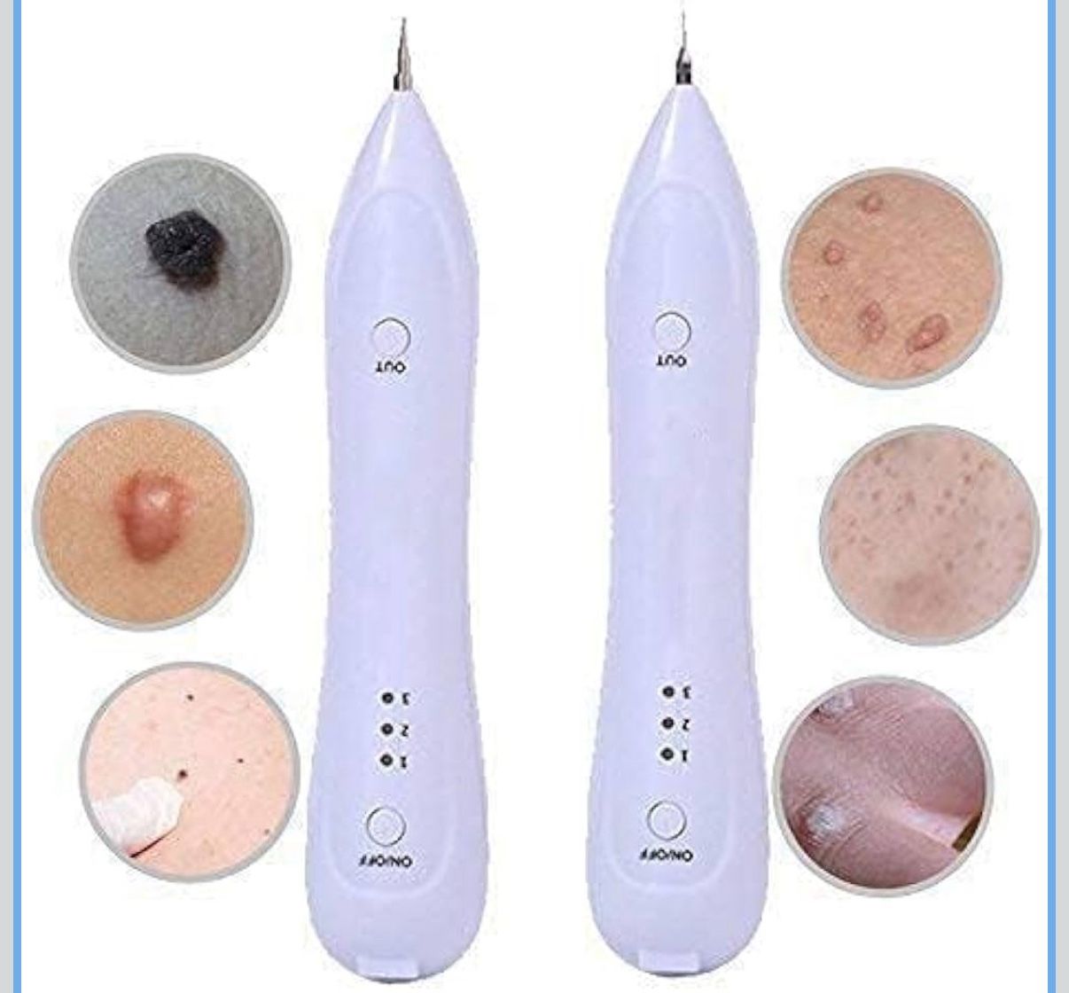 Electric Mole Remover Pen, Adjustable Multi-Speed, Freckle Skin Mole Dark Spot Removal Pen, Wart Remover Pen