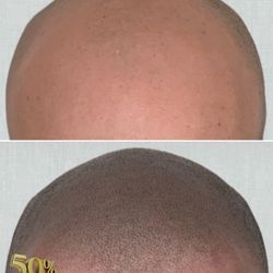 Permanent Shadow 