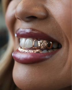 Rose Gold Diamond Cut Grillz Set