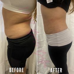 Lose Weight