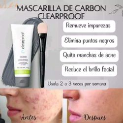 Problemas de acné