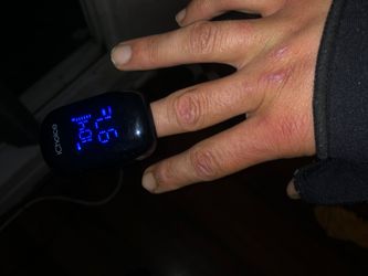 SOLD OUT EVERE HIGH DEMAND PULSE OXIMETER