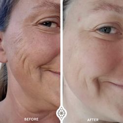 Facial Fascia Blaster Tool