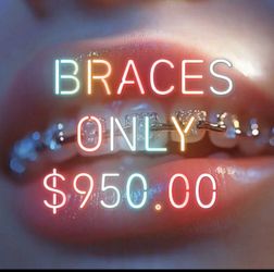 BRACES ONLY 450!!! Total!!!